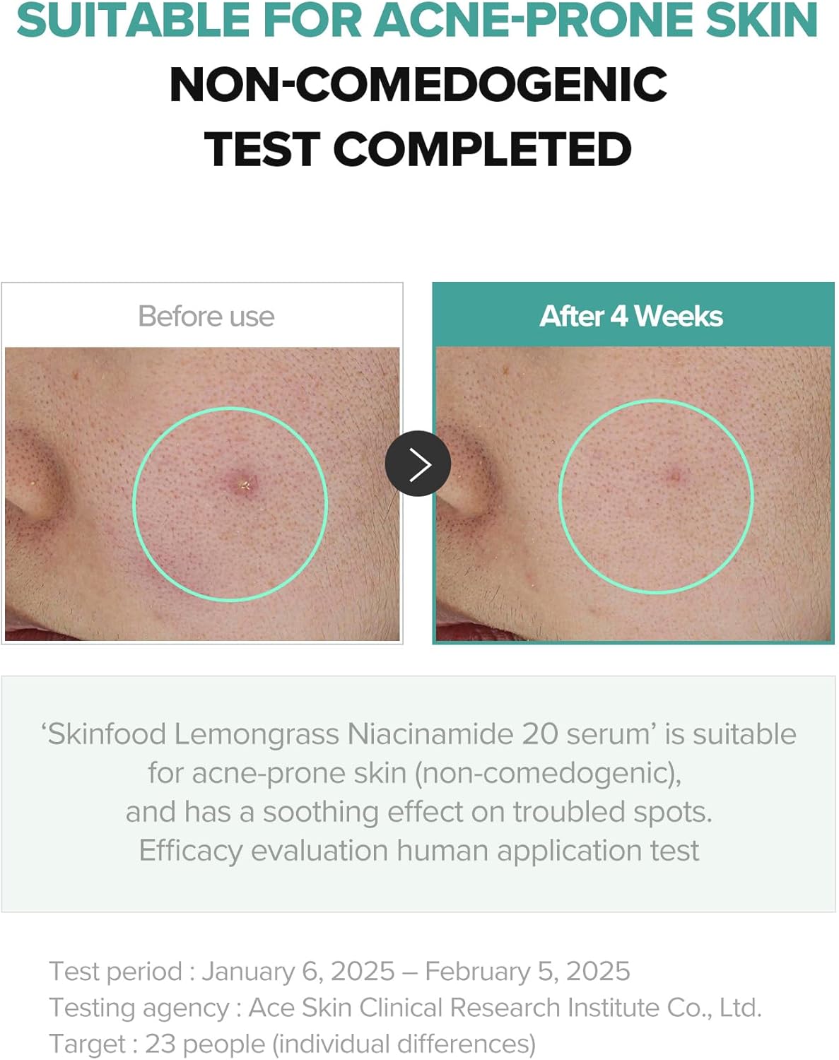 SKINFOOD Lemongrass Niacinamide 20 Serum – Brightening &amp; Oil Control Korean Skincare Serum